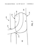 BALLOON CUFF TRACHEOSTOMY TUBE diagram and image