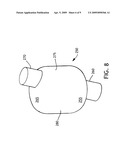 BALLOON CUFF TRACHEOSTOMY TUBE diagram and image