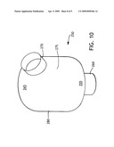 BALLOON CUFF TRACHEOSTOMY TUBE diagram and image