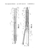 Surgical Stapling Apparatus diagram and image