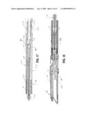 Surgical Stapling Apparatus diagram and image