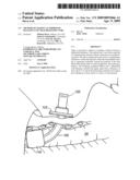 METHOD OF MAKING AN IMPROVED BALLOON CUFF TRACHEOSTOMY TUBE diagram and image