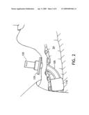 METHOD OF MAKING AN IMPROVED BALLOON CUFF TRACHEOSTOMY TUBE diagram and image