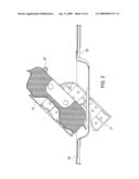 REINFORCEMENT DEVICE diagram and image