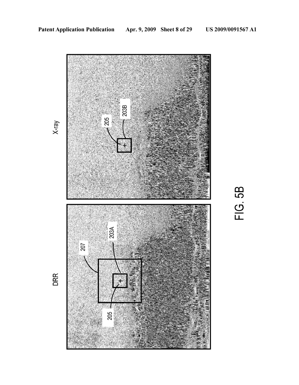 IMAGE ENHANCEMENT METHOD AND SYSTEM FOR FIDUCIAL-LESS TRACKING OF TREATMENT TARGETS - diagram, schematic, and image 09