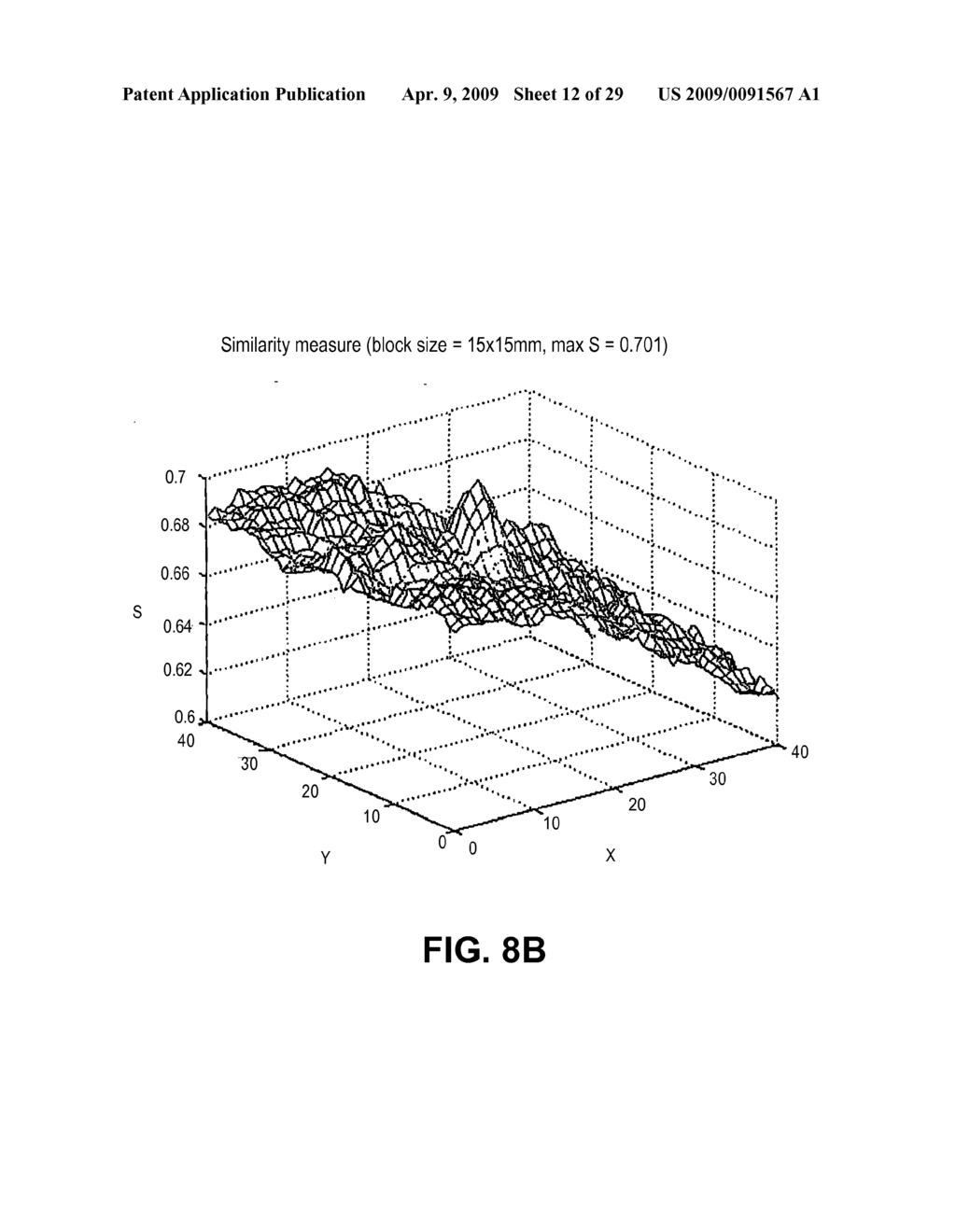 IMAGE ENHANCEMENT METHOD AND SYSTEM FOR FIDUCIAL-LESS TRACKING OF TREATMENT TARGETS - diagram, schematic, and image 13