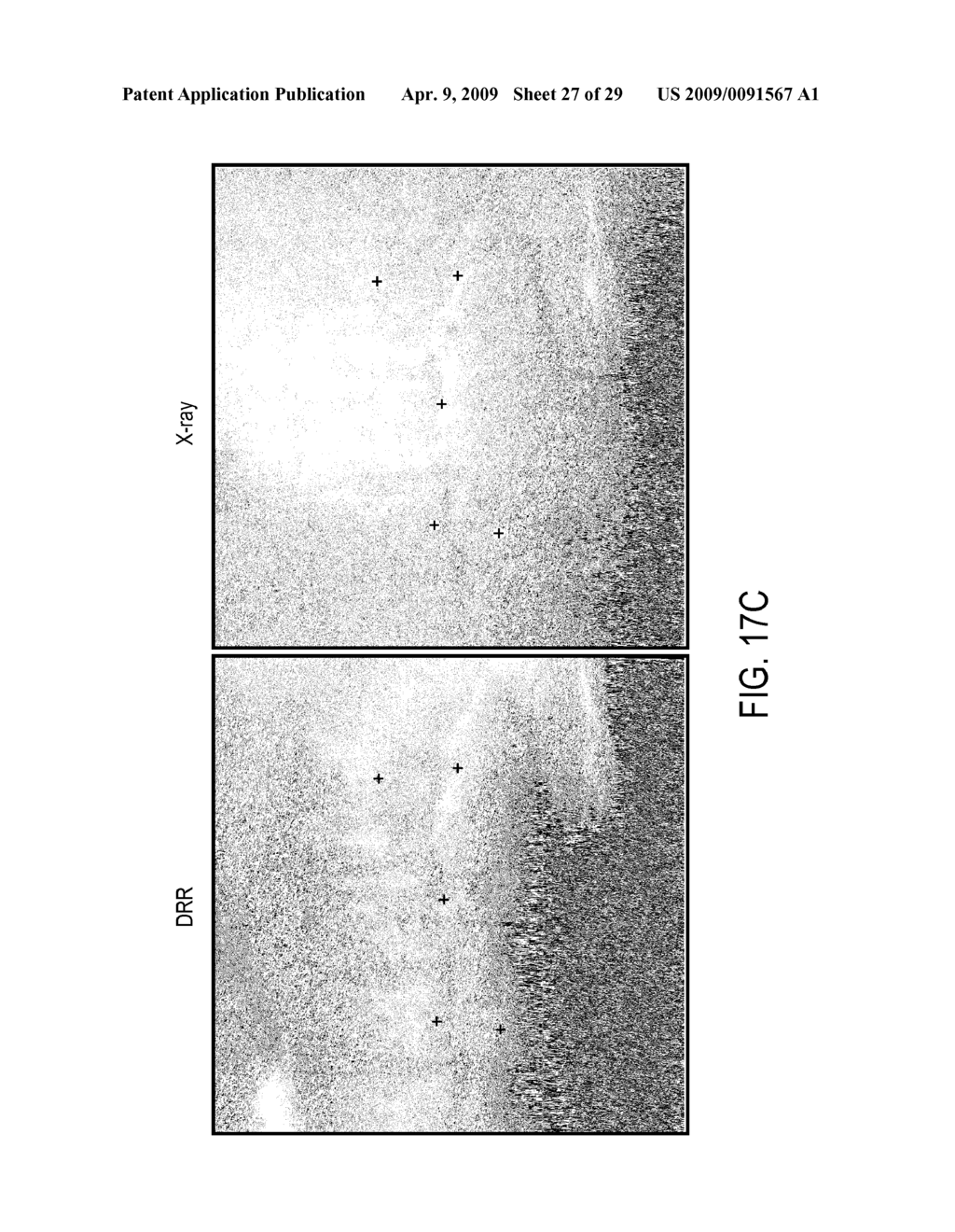 IMAGE ENHANCEMENT METHOD AND SYSTEM FOR FIDUCIAL-LESS TRACKING OF TREATMENT TARGETS - diagram, schematic, and image 28