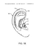 Energy Delivery and Microphone Placement Methods for Improved Comfort in an Open Canal Hearing Aid diagram and image