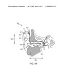 Energy Delivery and Microphone Placement Methods for Improved Comfort in an Open Canal Hearing Aid diagram and image