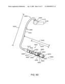 Energy Delivery and Microphone Placement Methods for Improved Comfort in an Open Canal Hearing Aid diagram and image