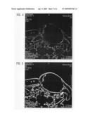 Method for detecting movements and correcting movements in tomographic and projective image series and tomography or projection system for implementing this method diagram and image