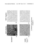 EARLY DIAGNOSIS AND TREATMENT OF DRUG RESISTANCE IN MUC1-POSITIVE CANCER diagram and image