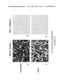 EARLY DIAGNOSIS AND TREATMENT OF DRUG RESISTANCE IN MUC1-POSITIVE CANCER diagram and image