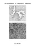 EARLY DIAGNOSIS AND TREATMENT OF DRUG RESISTANCE IN MUC1-POSITIVE CANCER diagram and image