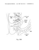 COMPOSITIONS CONTAINING MULTIPLE POLYMERS AND PARTICLES MADE USING THE COMPOSITIONS diagram and image