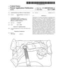 ASSISTED DENTAL IMPLANT TREATMENT diagram and image