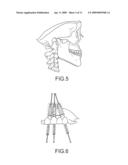 ASSISTED DENTAL IMPLANT TREATMENT diagram and image