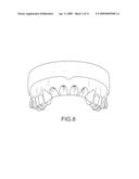 ASSISTED DENTAL IMPLANT TREATMENT diagram and image