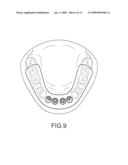 ASSISTED DENTAL IMPLANT TREATMENT diagram and image