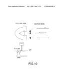 ASSISTED DENTAL IMPLANT TREATMENT diagram and image