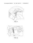 ASSISTED DENTAL IMPLANT TREATMENT diagram and image