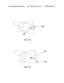 ASSISTED DENTAL IMPLANT TREATMENT diagram and image