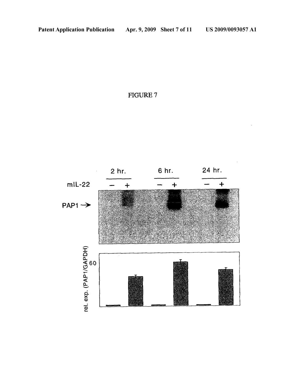 Interleukin-22 polypeptides, nucleic acids encoding the same and methods for the treatment of pancreatic disorders - diagram, schematic, and image 08