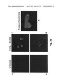 Method for treating cancer diagram and image