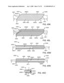 Treating Dysfunctional Cardiac Tissue diagram and image