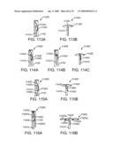 Treating Dysfunctional Cardiac Tissue diagram and image