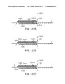 Treating Dysfunctional Cardiac Tissue diagram and image