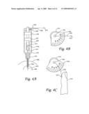 Methods and instruments for measuring tissue mechanical properties diagram and image