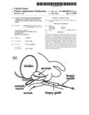 System and Method for Performing a Biopsy of a Target Volume and a Computing Device for Planning the Same diagram and image