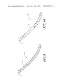 METHOD OF FLUID DELIVERY AND CATHETERS FOR USE WITH SAME diagram and image