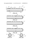 METHOD OF FLUID DELIVERY AND CATHETERS FOR USE WITH SAME diagram and image