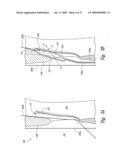 Systems and Methods for Transeptal Cardiac Procedures, Including Tissue Compression Devices and Methods diagram and image