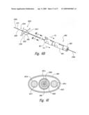 Systems and Methods for Transeptal Cardiac Procedures, Including Tissue Compression Devices and Methods diagram and image