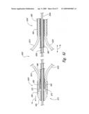 Systems and Methods for Transeptal Cardiac Procedures, Including Tissue Compression Devices and Methods diagram and image