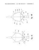 Systems and Methods for Transeptal Cardiac Procedures, Including Tissue Compression Devices and Methods diagram and image