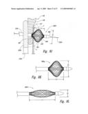 Systems and Methods for Transeptal Cardiac Procedures, Including Tissue Compression Devices and Methods diagram and image