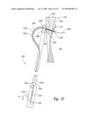 Systems and Methods for Transeptal Cardiac Procedures, Including Tissue Compression Devices and Methods diagram and image