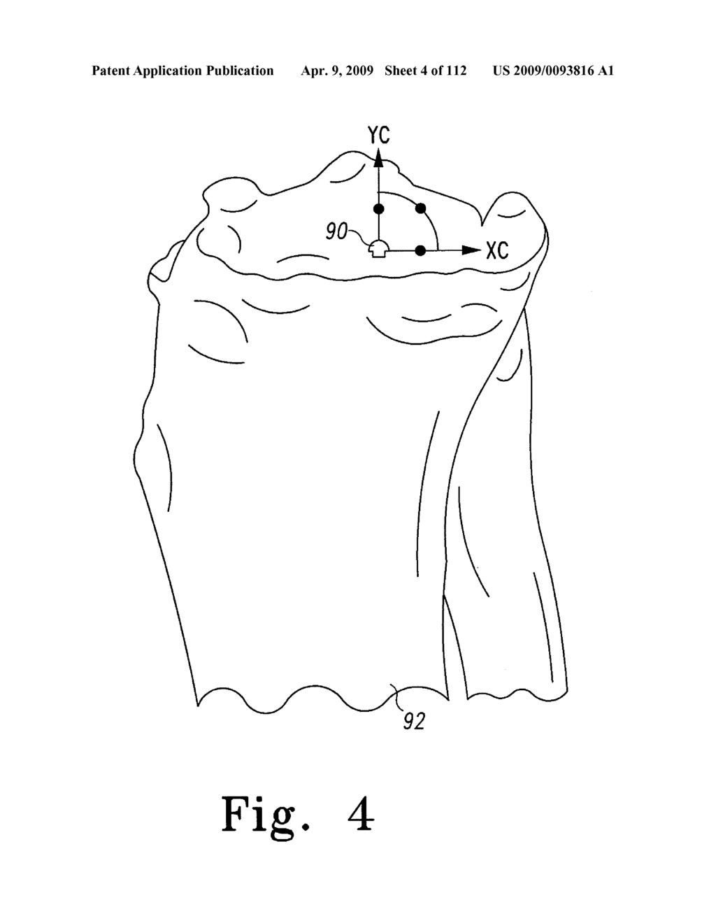 System and Method for Fabricating a Customized Patient-Specific Surgical Instrument - diagram, schematic, and image 05