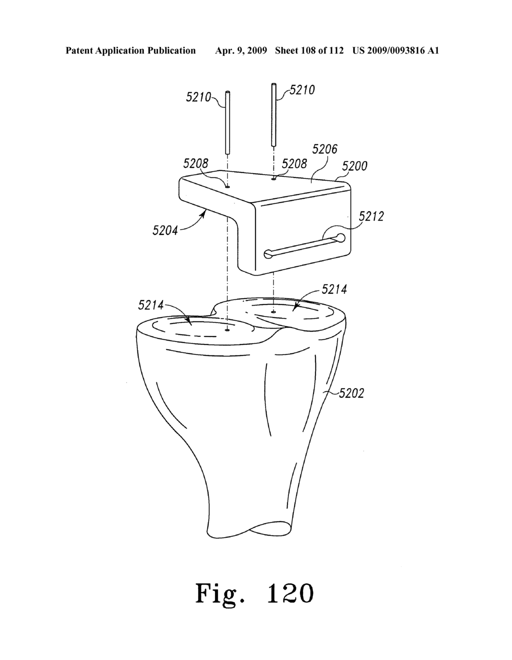 System and Method for Fabricating a Customized Patient-Specific Surgical Instrument - diagram, schematic, and image 109