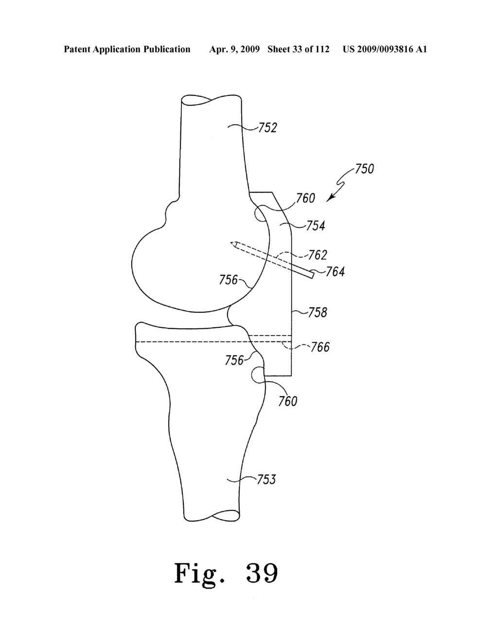 System and Method for Fabricating a Customized Patient-Specific Surgical Instrument - diagram, schematic, and image 34