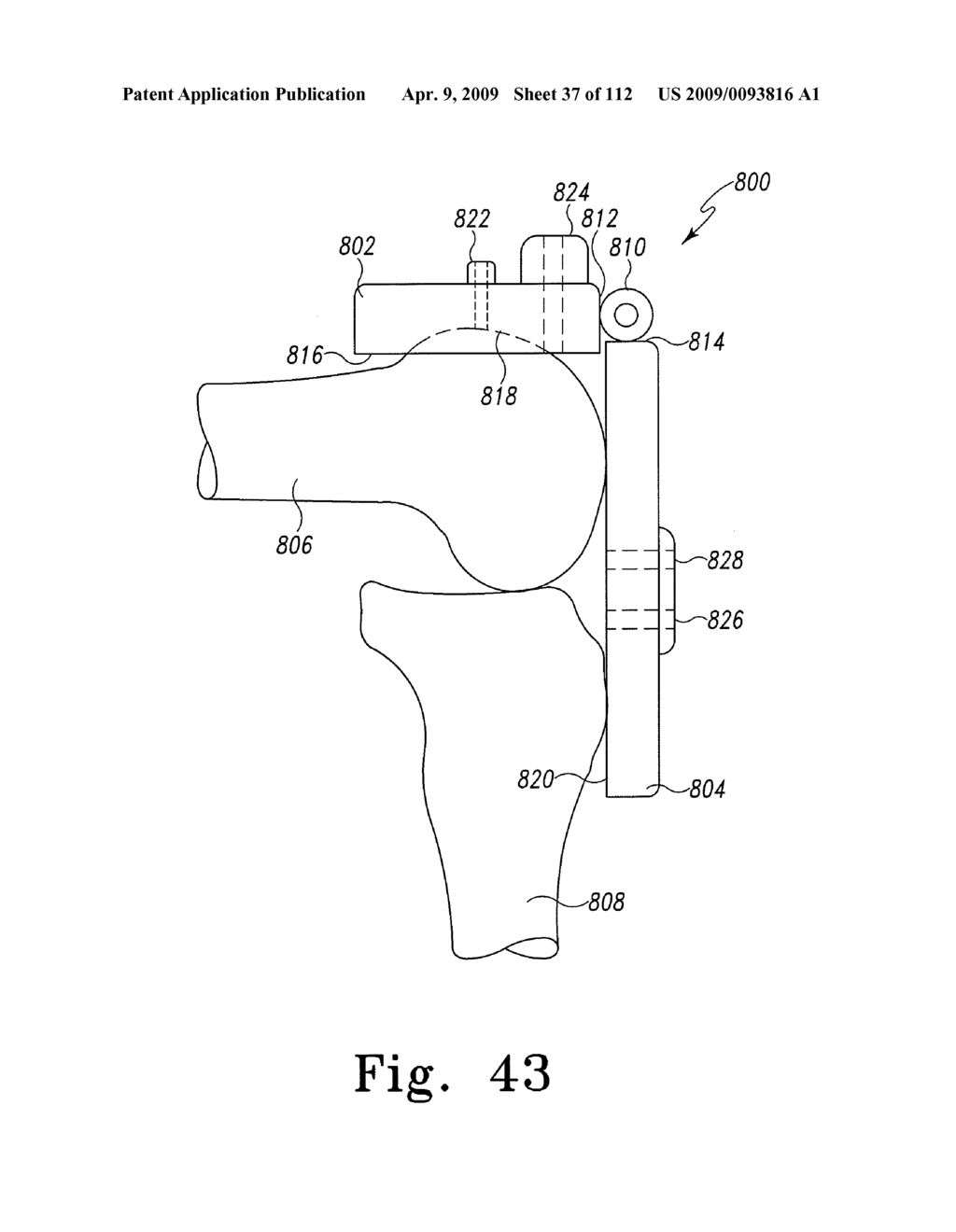 System and Method for Fabricating a Customized Patient-Specific Surgical Instrument - diagram, schematic, and image 38