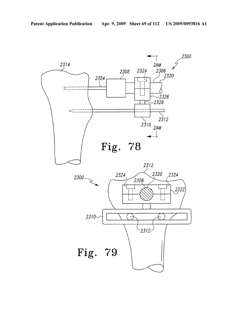 System and Method for Fabricating a Customized Patient-Specific Surgical Instrument - diagram, schematic, and image 70