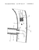 MAGNETIC STENT REMOVAL diagram and image