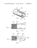 MAGNETIC STENT REMOVAL diagram and image