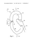 Methods for reducing hydrostatic organ pressure diagram and image