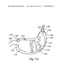 Methods for reducing hydrostatic organ pressure diagram and image